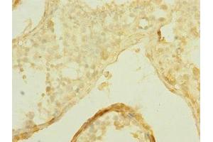 Immunohistochemistry of paraffin-embedded human testis tissue using ABIN7170303 at dilution of 1:100 (SLCO2B1 抗体  (AA 130-210))