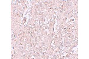 Immunohistochemical staining of human spleen cells with SLC39A13 polyclonal antibody  at 2. (SLC39A13 抗体  (N-Term))