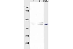 Lane 1: mouse embryo lysates Lane 2: mouse brain lysates probed with Anti TNFAIP5/Pentraxin 3 Polyclonal Antibody, Unconjugated (ABIN714686) at 1:200 in 4 °C. (PTX3 抗体  (AA 151-250))