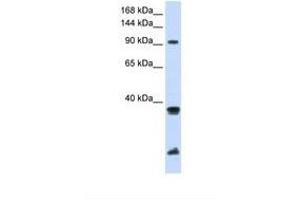 Image no. 1 for anti-Ring Finger Protein 20 (RNF20) (AA 576-625) antibody (ABIN6738066) (RNF20 抗体  (AA 576-625))