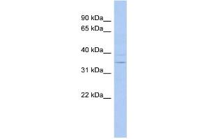 WB Suggested Anti-ASPDH Antibody Titration: 0. (ASPDH 抗体  (N-Term))