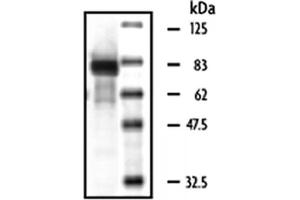 Western Blotting (WB) image for Macrophage Stimulating 1 (Hepatocyte Growth Factor-Like) (MST1) (Active) protein (ABIN2669400) (MST1 蛋白)