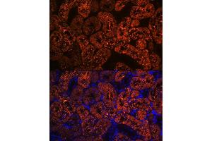 Immunofluorescence analysis of rat kidney using FBP1 Rabbit mAb (ABIN7267269) at dilution of 1:100 (40x lens).