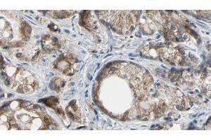 ABIN6277180 at 1/100 staining Human prostate tissue by IHC-P. (ABCC4 抗体)