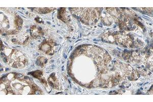 ABIN6277180 at 1/100 staining Human prostate tissue by IHC-P. (ABCC4 抗体)