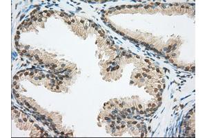 Immunohistochemical staining of paraffin-embedded pancreas tissue using anti-ERCC1 mouse monoclonal antibody. (ERCC1 抗体)