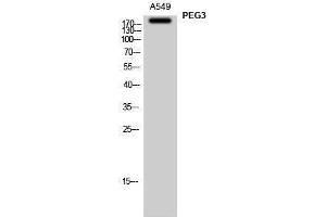 Western Blotting (WB) image for anti-Paternally Expressed 3 (PEG3) (Internal Region) antibody (ABIN3186389) (PEG3 抗体  (Internal Region))