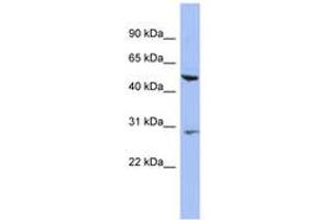 Image no. 1 for anti-Keratin 75 (KRT75) (N-Term) antibody (ABIN6744317) (Keratin 75 抗体  (N-Term))