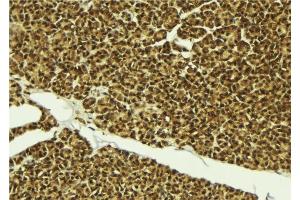 ABIN6279302 at 1/100 staining Mouse pancreas tissue by IHC-P. (CMTM8 抗体  (Internal Region))