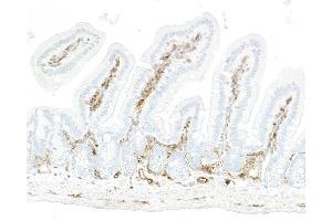 anti-Ectonucleoside Triphosphate diphosphohydrolase 1 (ENTPD1) (AA 300-350) antibody