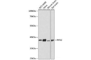 Western blot analysis of extracts of various cell lines using PITX2 Polyclonal Antibody at dilution of 1:3000. (PITX2 抗体)