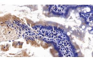 Detection of AXIN in Rat Small intestine Tissue using Polyclonal Antibody to Axis Inhibition Protein (AXIN) (Axin 抗体  (AA 618-827))