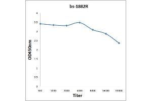 Antigen: 0. (MRAS 抗体  (AA 105-208))