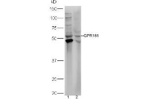 Lane 1: HepG2 lysates Lane 2: HL-60  lysates probed with Rabbit Anti-GPR161 Polyclonal Antibody, Unconjugated (ABIN2174751) at 1:300 overnight at 4 °C. (GPR161 抗体  (AA 121-220))