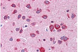 Human Brain, Cortex: Formalin-Fixed, Paraffin-Embedded (FFPE) (Calneuron 1 抗体  (N-Term))