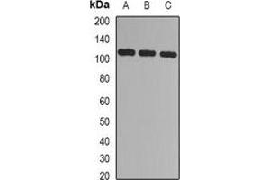 Western blot analysis of CBLB expression in Jurkat (A), 293T (B), mouse spleen (C) whole cell lysates. (Cbl Proto-Oncogene B, E3 Ubiquitin Protein Ligase (CBLB) 抗体)