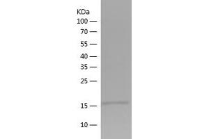 MYL9 Protein (AA 1-118) (His tag)