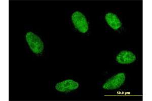 Immunofluorescence of monoclonal antibody to GBX2 on HeLa cell. (GBX2 抗体  (AA 114-182))
