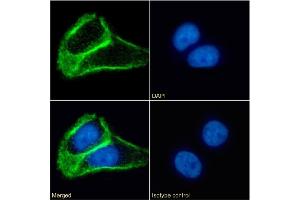 Immunofluorescence staining of fixed A431 cells with anti-Tetraspanin 1 antibody 4/12. (Recombinant TSPAN1 抗体  (Extracellular Domain))