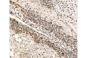 IHC analysis of SSB using anti-SSB antibody (ABIN7602125). (SSB 抗体  (AA 6-283))