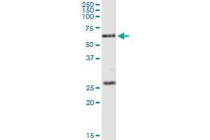Immunoprecipitation of POLK transfected lysate using anti-POLK monoclonal antibody and Protein A Magnetic Bead , and immunoblotted with POLK MaxPab rabbit polyclonal antibody. (POLK 抗体  (AA 1-472))