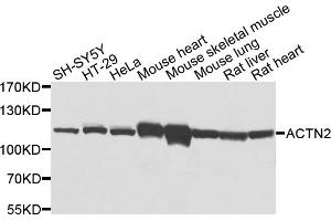 Western blot analysis of extracts of various cell lines, using ACTN2 antibody (ABIN5971910) at 1/1000 dilution. (ACTN2 抗体)