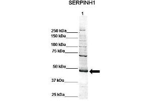 Western Blotting (WB) image for anti-Serpin Family H Member 1 (SERPINH1) (C-Term) antibody (ABIN2792207)