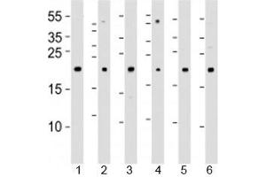 Western blot analysis of lysate from 1) 293T, 2) HeLa, 3) Jurkat, 4) Y79 cell line , 5) mouse spleen and 6) rat kidney tissue lysate using DHFR antibody at 1:1000. (Dihydrofolate Reductase 抗体  (AA 1-50))