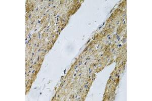 Immunohistochemistry of paraffin-embedded human smooth muscle using VCL Antibody. (Vinculin 抗体  (AA 767-1066))