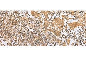 Immunohistochemistry of paraffin-embedded Human tonsil tissue using NDUFB3 Polyclonal Antibody at dilution of 1:25(x200)