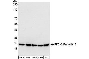 anti-Prefoldin Subunit 2 (PFDN2) (AA 104-154) antibody