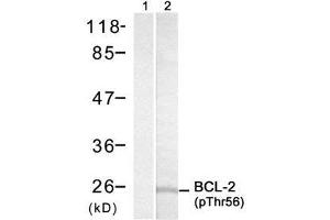 Image no. 1 for anti-B-Cell CLL/lymphoma 2 (BCL2) (pThr56) antibody (ABIN273337) (Bcl-2 抗体  (pThr56))