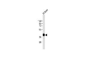 Anti-AGXT Antibody (Center)at 1:8000 dilution + human liver lysates Lysates/proteins at 20 μg per lane. (AGXT 抗体  (AA 96-125))