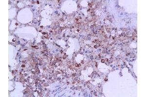 Formalin-fixed and paraffin embedded mouse lung tissue labeled with Anti-IL-6(mo, rat) Polyclonal Antibody, Unconjugated (ABIN728083) at 1:200, followed by conjugation to the secondary antibody and DAB staining