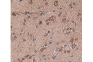 Used in DAB staining on fromalin fixed paraffin- embedded brain tissue (NAT8L 抗体  (AA 1-302))