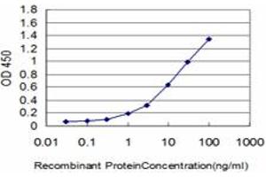 Detection limit for recombinant GST tagged IRAK2 is approximately 0. (IRAK2 抗体  (AA 111-210))