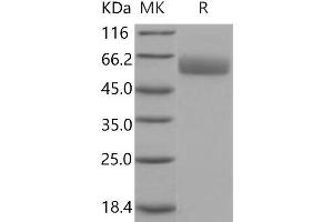 SERPINA7 Protein (His tag)