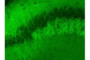 Indirect immunolabeling of PFA fixed mouse hippocampus sections (dilution 1 : 500) (VAMP2 抗体  (AA 2-17))