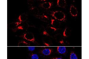 Immunofluorescence analysis of HeLa cells using USO1 Polyclonal Antibody at dilution of 1:200 (60x lens). (USO1 抗体)