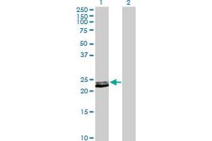 Western Blot analysis of PRL expression in transfected 293T cell line by PRL MaxPab polyclonal antibody. (Prolactin 抗体  (AA 1-227))
