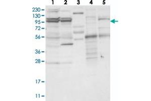Western blot analysis of Lane 1: RT-4, Lane 2: U-251 MG, Lane 3: Human Plasma, Lane 4: Liver, Lane 5: Tonsil with TBC1D5 polyclonal antibody . (TBC1D5 抗体)