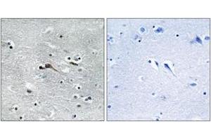 Immunohistochemistry (IHC) image for anti-Cytokine-Like 1 (CYTL1) (AA 61-110) antibody (ABIN6766393) (CYTL1 抗体  (AA 61-110))