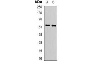 Western blot analysis of LIPI expression in Jurkat (A), HepG2 (B) whole cell lysates. (Lipase I 抗体)
