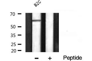 Western Blotting (WB) image for anti-V-Akt Murine Thymoma Viral Oncogene Homolog 1 (AKT1) (pThr450) antibody (ABIN6256564)