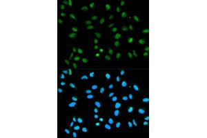 Immunofluorescence analysis of HeLa cells using HNRNPA2B1 antibody (ABIN5970508). (HNRNPA2B1 抗体)