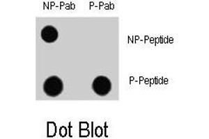 Dot blot analysis of MAP1LC3A (phospho S12) polyclonal antibody  and Nonphospho-MAP1LC3 antibody on nitrocellulose membrane. (MAP1LC3A 抗体  (pSer12))