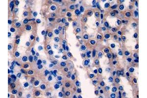 DAB staining on IHC-P; Samples: Rat Kidney Tissue (Ladinin 1 抗体  (AA 1-140))
