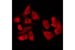 ABIN6276229 staining COLO205 by IF/ICC. (TAS2R8 抗体  (Internal Region))