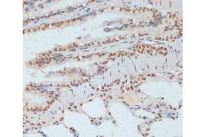 Immunohistochemistry of paraffin-embedded Rat lung using Phospho-p53(S33) Polyclonal Antibody at dilution of 1:100 (40x lens). (p53 抗体  (pSer33))