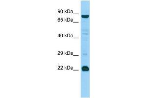 WB Suggested Anti-MED22 Antibody Titration: 1. (MED22 抗体  (Middle Region))